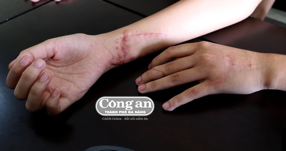 Suy nghĩ nông cạn của gã em chồng trước khi gây tội với chị dâu