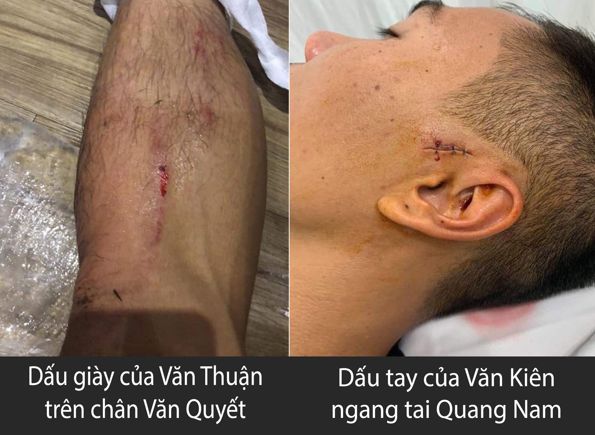 Dư âm trận CLB TP HCM - Hà Nội FC: Tố nhau đá xấu, chê cả trọng tài, kiện lên cả BTC