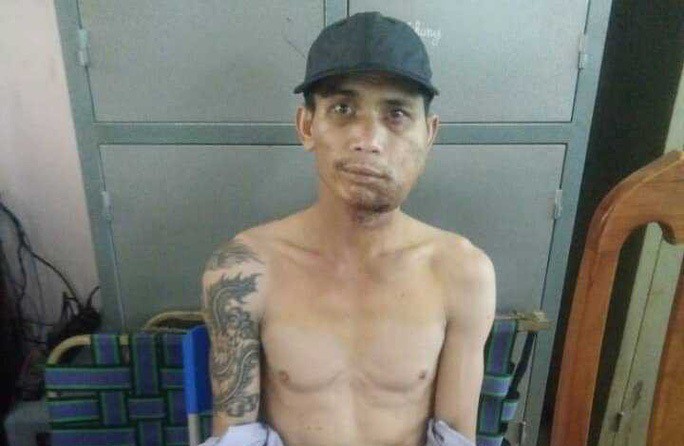 Gã đàn ông bắn người tình rồi bỏ trốn khỏi bệnh viện bị tóm ở Đà Nẵng