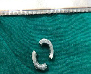 Cưa ốc kim loại giải cứu "của quý" của bé trai 11 tuổi
