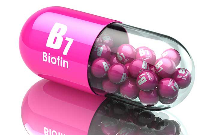 8 cách đơn giản chống rụng tóc do rối loạn tuyến giáp - Ảnh 1.