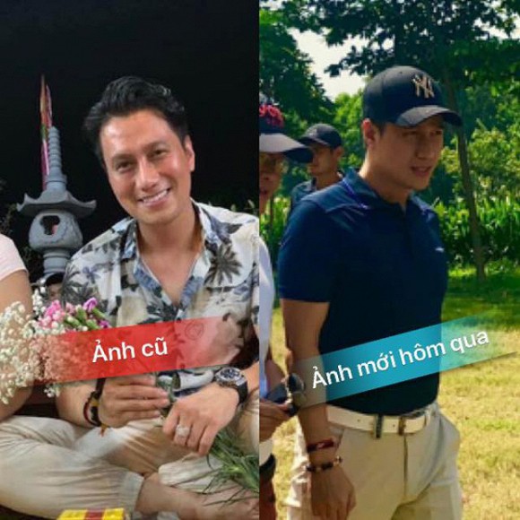 Việt Anh n&oacute;i l&yacute; do đi thẩm mỹ - Ảnh 1.
