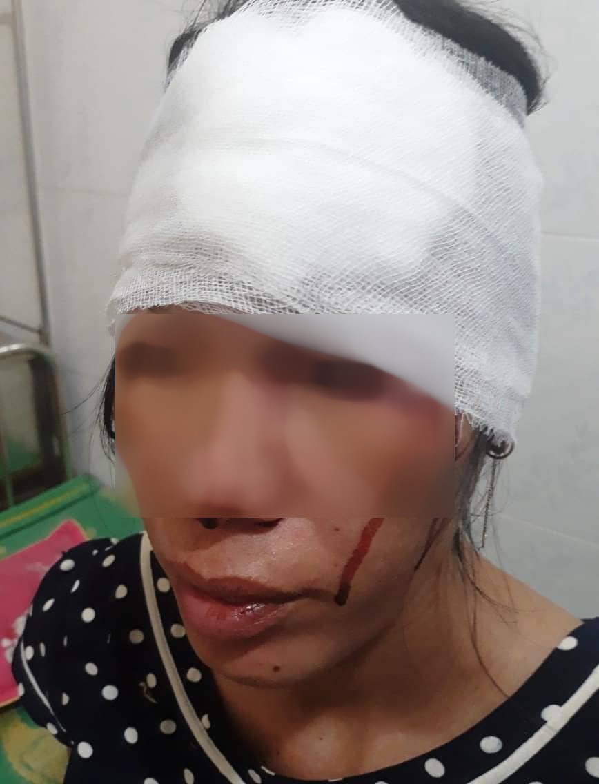 Người phụ nữ khuyết tật đang mang thai bị đ&aacute;nh nhập viện - Ảnh 1.