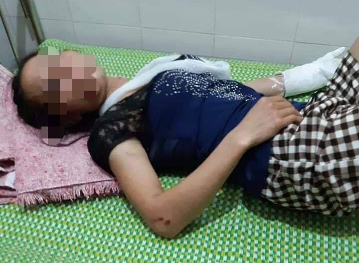 Mâu thuẫn gia đình, chồng đánh vợ gãy tay