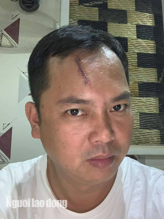 Giang hồ v&acirc;y xe chở c&ocirc;ng an ở Đồng Nai: Người bị đ&aacute;nh y&ecirc;u cầu khởi tố - Ảnh 1.