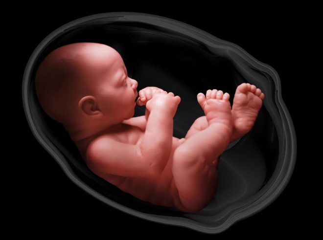Những đứa bé bị nhầm giới tính do dị tật vùng kín