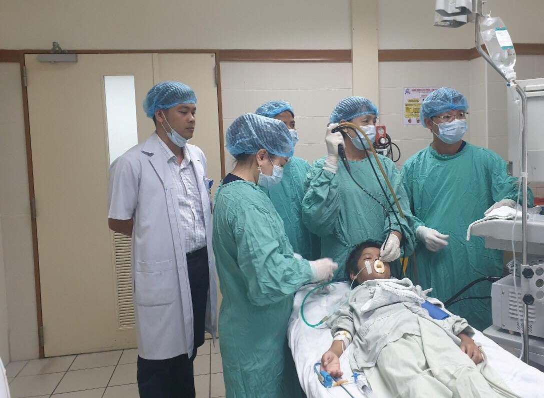 Trẻ 10 tuổi bị mảnh xương cá găm trong phổi suốt một tháng
