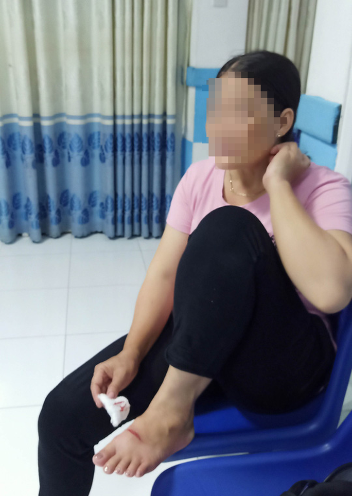 Chó dữ tấn công nhiều người giữa chợ dương tính với bệnh dại - Ảnh 1.
