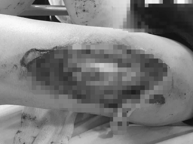 Chủ tịch H&agrave; Nội: L&agrave;m r&otilde; tr&aacute;ch nhiệm trong c&ocirc;ng t&aacute;c bảo vệ vụ CĐV bị trọng thương do ph&aacute;o s&aacute;ng - Ảnh 2.