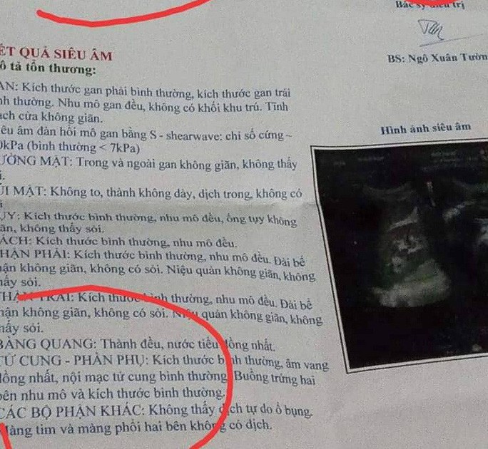Cười ra nước mắt khi &ocirc;ng chồng bỗng... c&oacute; tử cung, buồng trứng - Ảnh 1.