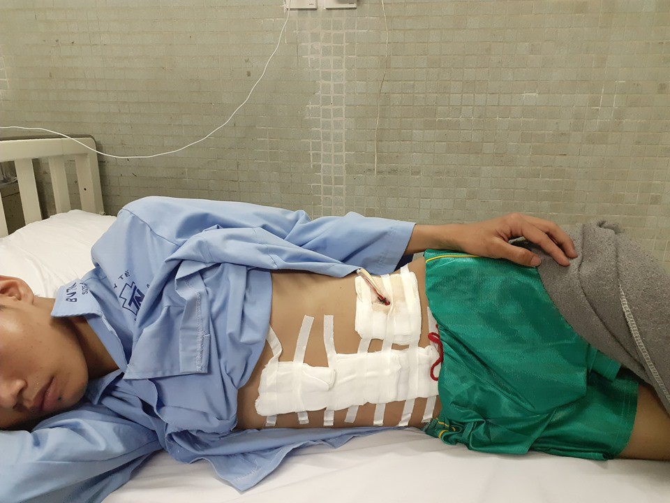 Vừa vào TP HCM tìm việc sau bão lũ, chàng trai miền Trung mất cả lách tụy