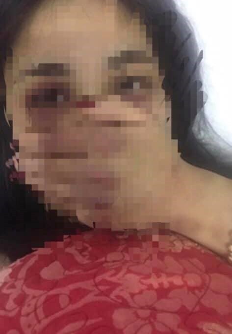 Vụ bác sĩ hành hung nữ điều dưỡng: Do chống cự vì bị sàm sỡ?