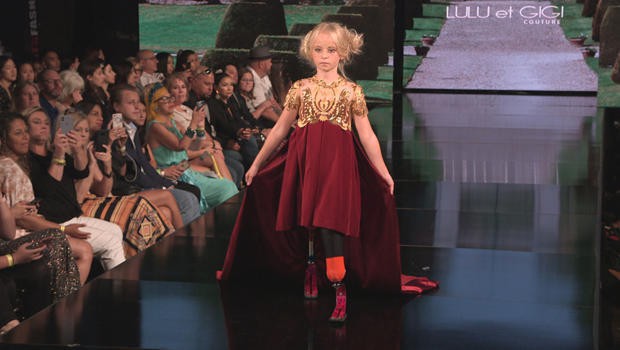 Mẫu nhí không chân làm nên lịch sử trên sàn catwalk - Ảnh 5.