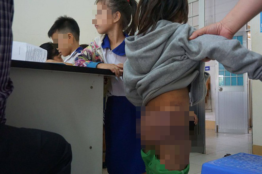 2 chị gái bạo hành dã man 4 anh em họ ở Cà Mau