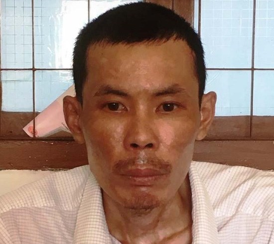 Thêm tội cho người chồng đốt vợ vì không chịu nấu cơm