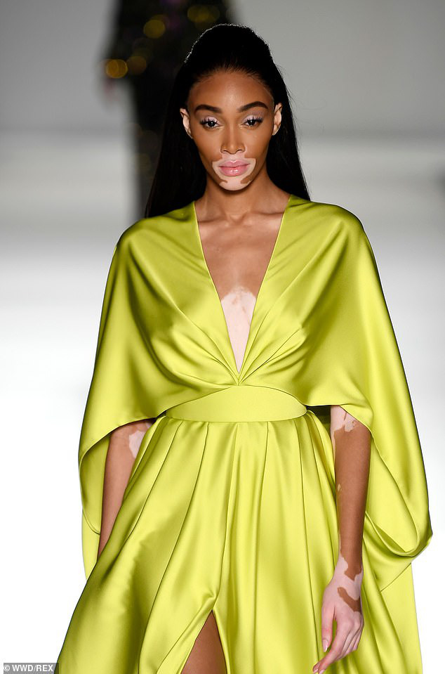 Người mẫu bạch biến Winnie Harlow đẹp dịu dàng trên sàn diễn - Ảnh 2.