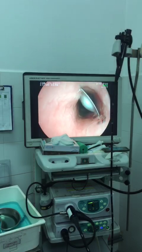 CLIP: Bệnh nh&acirc;n cao huyết &aacute;p su&yacute;t trả gi&aacute; đắt do uống thuốc qu&aacute; nhanh - Ảnh 2.