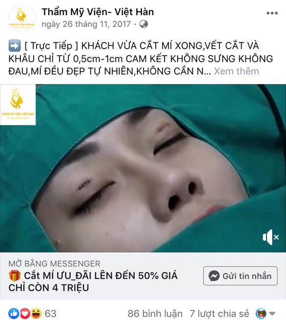 Đàn ông đi cắt mí, hút mỡ: những điều cần cảnh giác