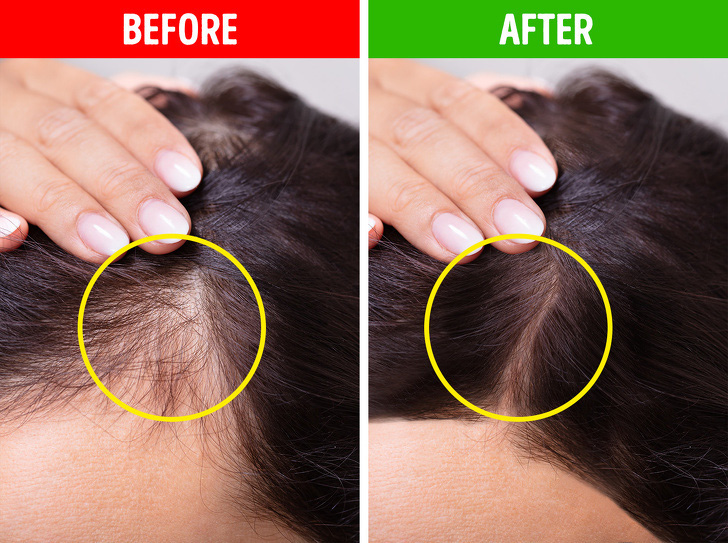 9 mẹo h&ocirc; biến t&oacute;c mỏng, g&atilde;y rụng trở n&ecirc;n chắc khỏe - Ảnh 9.
