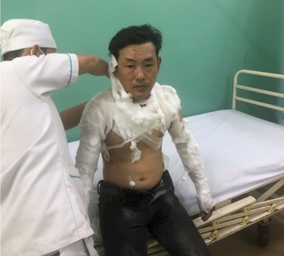 Hành động quái dị của kẻ cướp ngân hàng ở Bình Tân