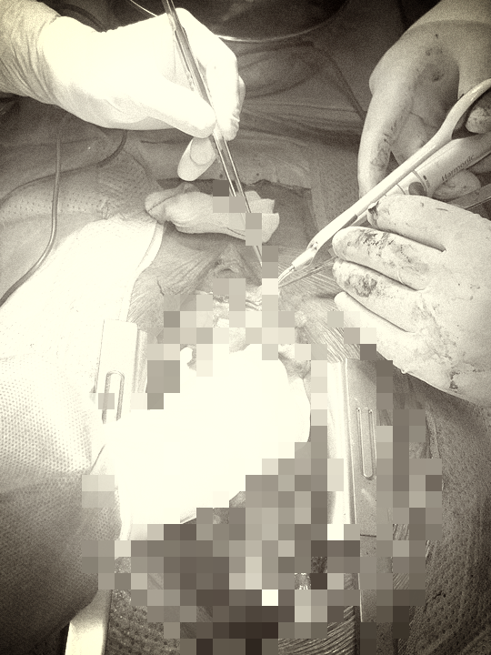 Th&ecirc;m 1 người đ&agrave;n &ocirc;ng su&yacute;t mất mạng v&igrave; h&uacute;t thuốc l&aacute; nhiều - Ảnh 2.