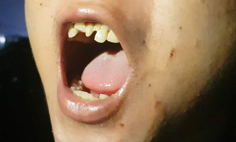 Hỏa tốc điều tra vụ chủ qu&aacute;n b&aacute;nh x&egrave;o Miền Trung bạo h&agrave;nh d&atilde; man 2 nh&acirc;n vi&ecirc;n - Ảnh 1.