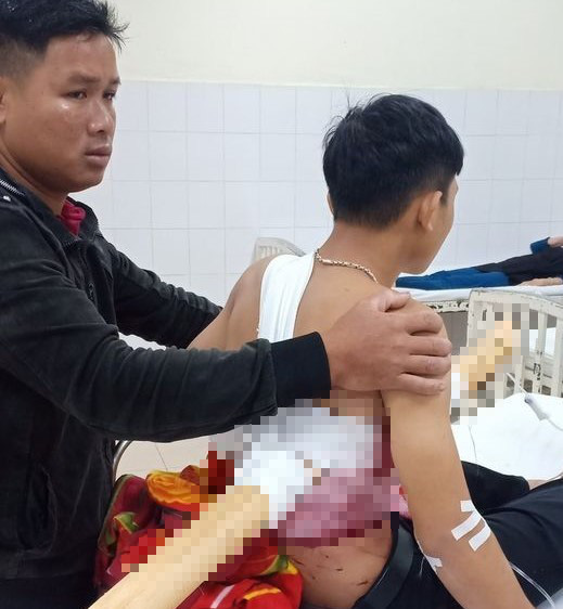 Sốc với hình ảnh một thiếu niên bị cây keo đâm xuyên người