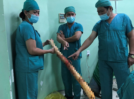 Sốc với h&igrave;nh ảnh một thiếu ni&ecirc;n bị c&acirc;y keo đ&acirc;m xuy&ecirc;n người - Ảnh 2.