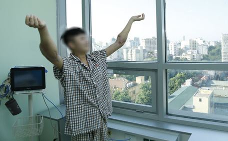 Thanh niên được ghép 2 tay và 5 người ghép tạng từ người hiến chết não