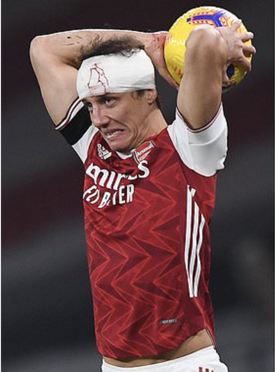 Không chiến kinh hoàng, sao Wolves nứt hộp sọ, David Luiz khâu đầu 7 mũi - Ảnh 5.