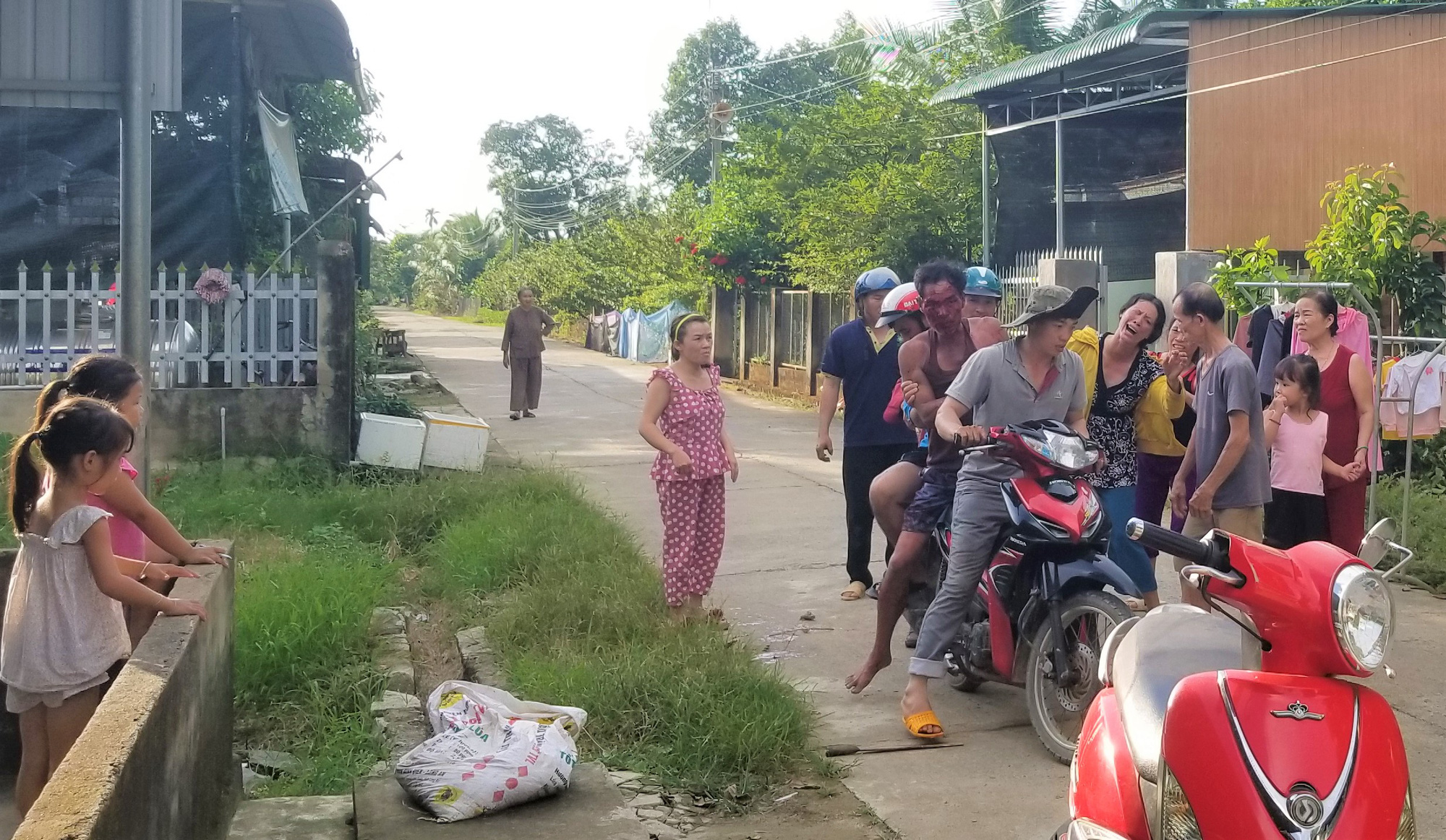 Mâu thuẫn trong lúc nhậu, 1 người bị chém nhập viện