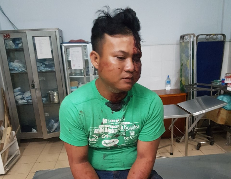 Em rể đâm chết anh vợ sau khi nhậu về