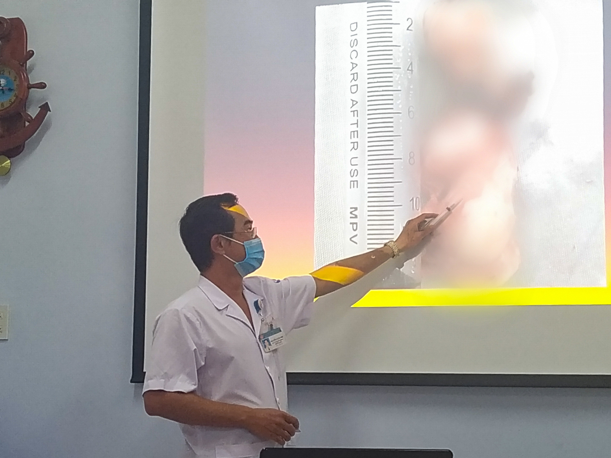 Chảy máu cam nhiều lần, cậu bé được phát hiện có khối u nguy hiểm - Ảnh 2.