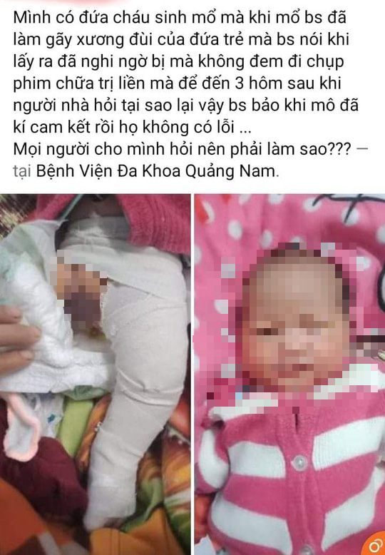 Bệnh viện Đa khoa Quảng Nam b&aacute;o c&aacute;o việc b&eacute; trai g&atilde;y ch&acirc;n khi sinh mổ - Ảnh 3.