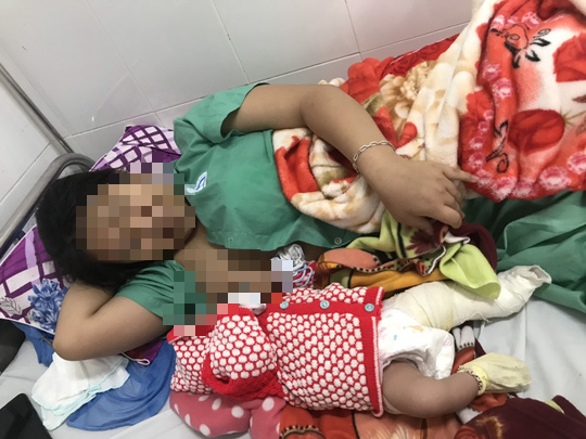 Bệnh viện Đa khoa Quảng Nam b&aacute;o c&aacute;o việc b&eacute; trai g&atilde;y ch&acirc;n khi sinh mổ - Ảnh 2.