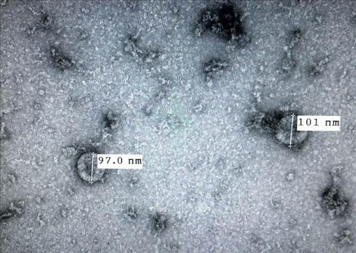 Bộ Y tế nói gì về biến thể virus SARS-CoV-2 mới gây lây nhiễm cao ở Anh?