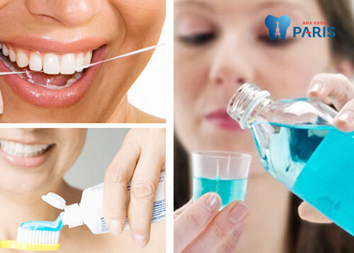 Niềng răng có hết móm không? - Ảnh 3.