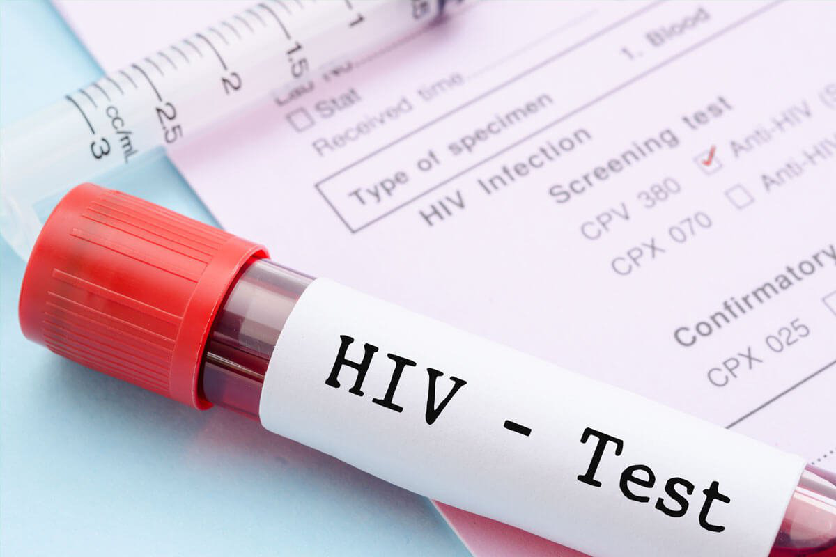 V&igrave; sao độ tuổi được x&eacute;t nghiệm HIV tự nguyện giảm xuống đủ 15 tuổi? - Ảnh 1.