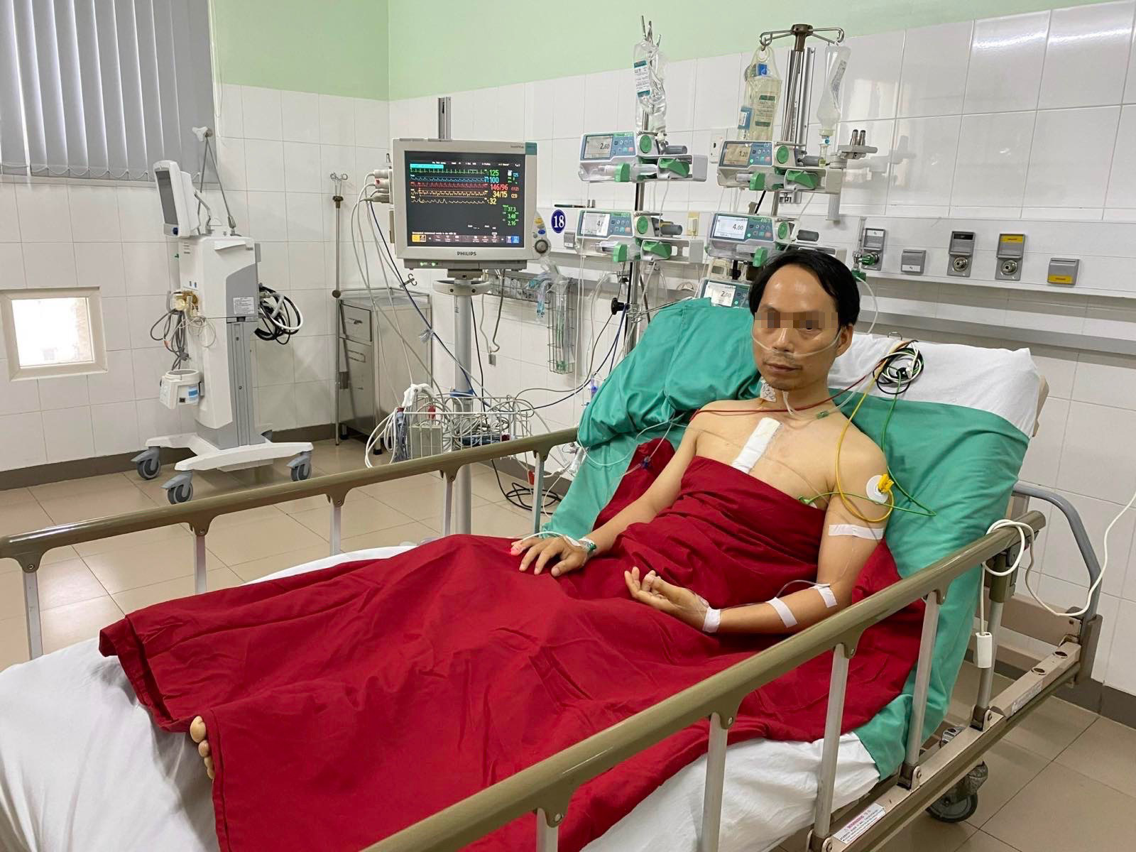Bệnh viện Trung ương Huế ghép tim thành công cho thanh niên 34 tuổi - Ảnh 3.