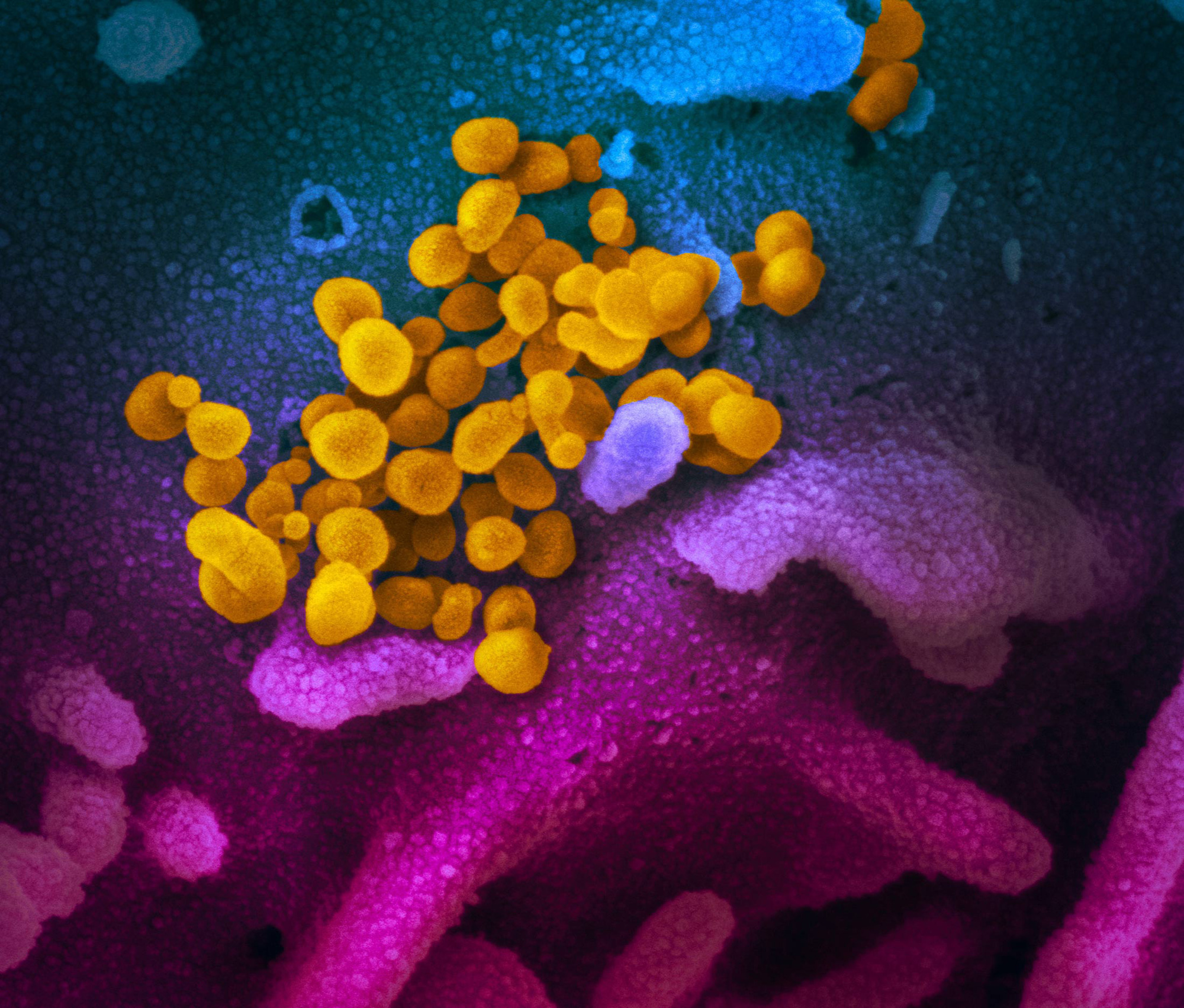 Tiết lộ h&igrave;nh ảnh mới của virus corona chủng mới - Ảnh 2.