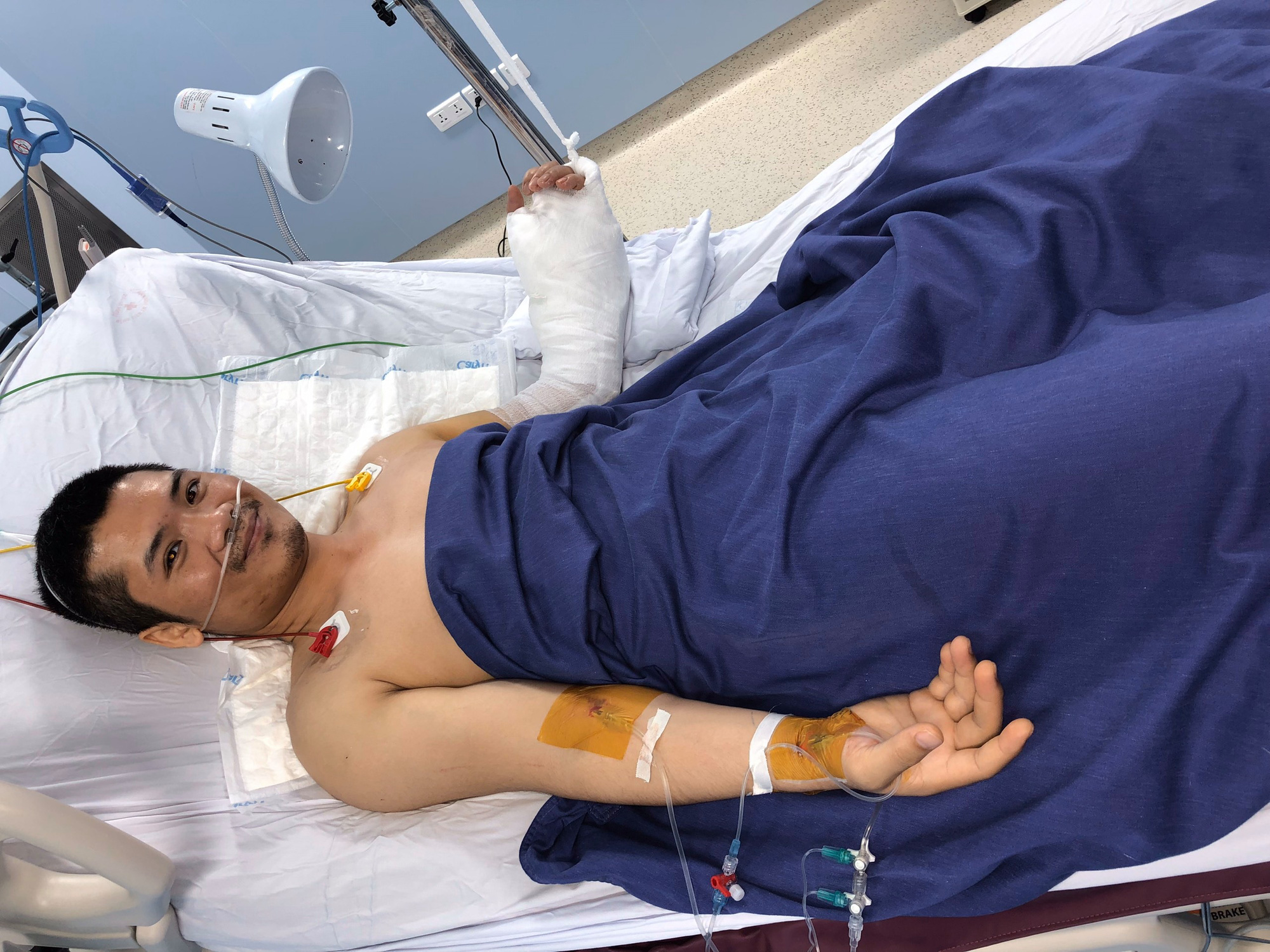 Việt Nam thực hiện th&agrave;nh c&ocirc;ng ca gh&eacute;p chi thể đầu ti&ecirc;n tr&ecirc;n thế giới từ người hiến sống - Ảnh 4.