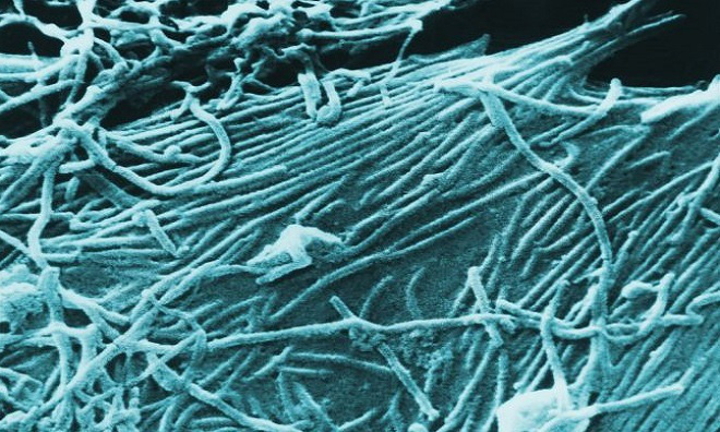 9 virus nguy hiểm tr&ecirc;n tr&aacute;i đất - Ảnh 2.