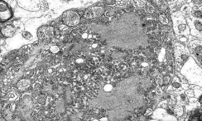 9 virus nguy hiểm tr&ecirc;n tr&aacute;i đất - Ảnh 3.