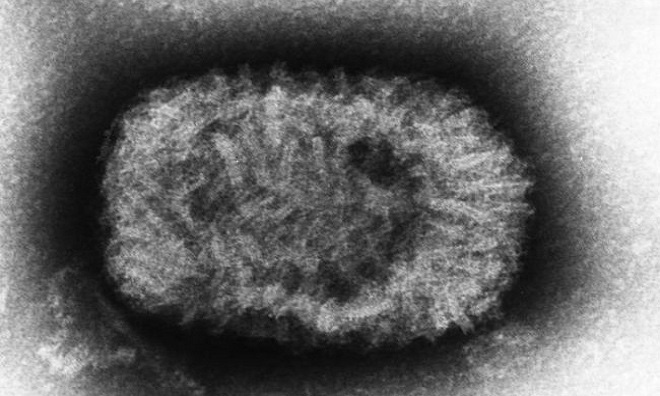 9 virus nguy hiểm tr&ecirc;n tr&aacute;i đất - Ảnh 5.