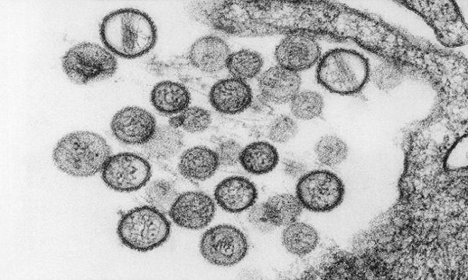 9 virus nguy hiểm tr&ecirc;n tr&aacute;i đất - Ảnh 6.