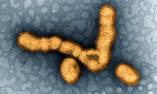 9 virus nguy hiểm tr&ecirc;n tr&aacute;i đất - Ảnh 7.