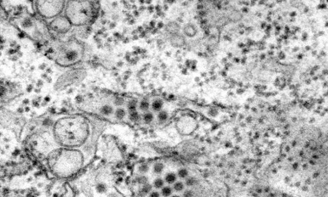 9 virus nguy hiểm tr&ecirc;n tr&aacute;i đất - Ảnh 8.