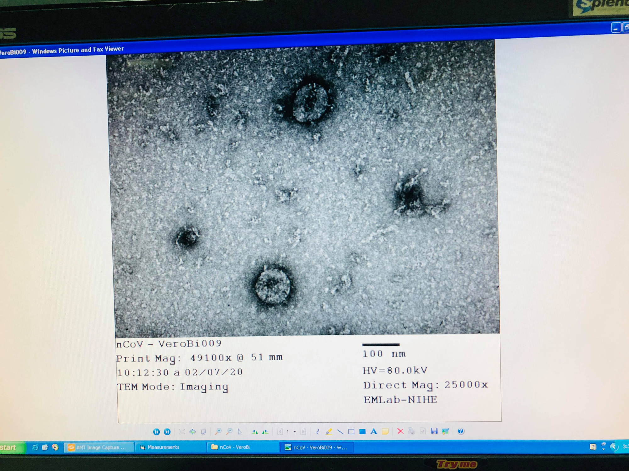 Việt Nam nuôi cấy và phân lập thành công virus nCoV - Ảnh 1.