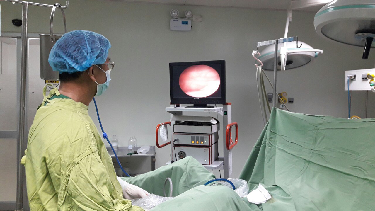 Hy hữu đứt ống thông JJ 3 đoạn khi ống thông để trong niệu quản suốt 3 năm