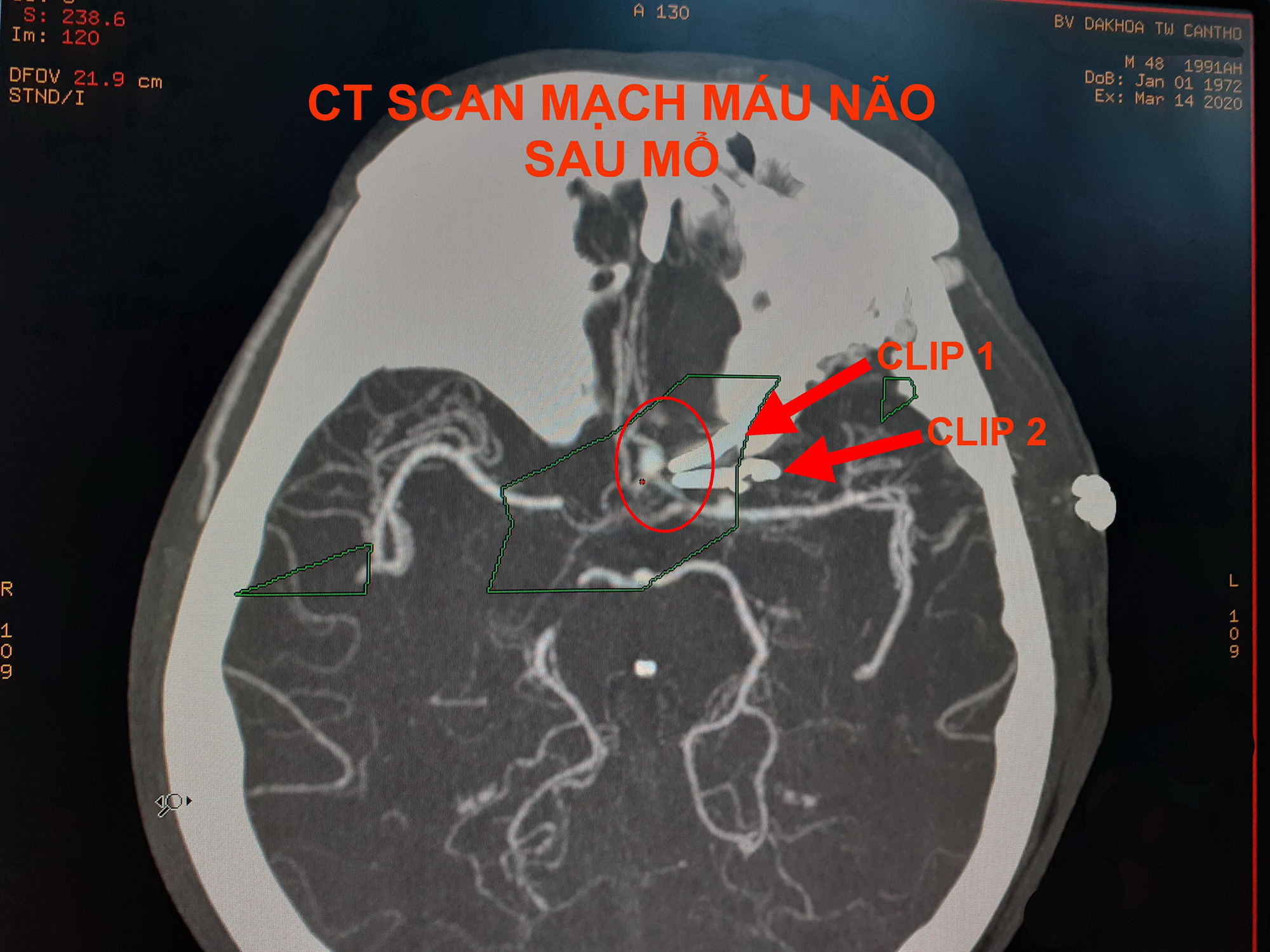 4 giờ căng thẳng gi&agrave;nh lấy sự sống cho người đ&agrave;n &ocirc;ng đối diện c&aacute;i chết - Ảnh 2.